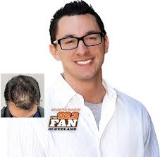 Ohio Hair Restoration & Hair Transplant Experts