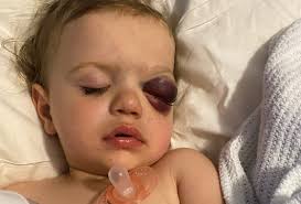 Millie's story #LittleHero