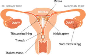 Maybe you would like to learn more about one of these? The Women S Center At Southwest Health Iud