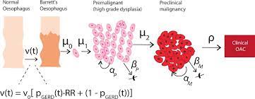 We did not find results for: Computational Modelling Suggests That Barrett S Oesophagus May Be The Precursor Of All Oesophageal Adenocarcinomas Gut