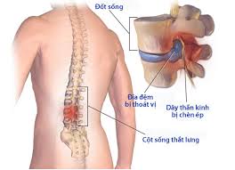 Đặc điểm của các đốt sống thắt lưng | Vinmec