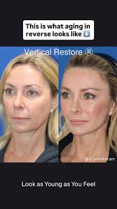 The update you've been waiting for🙏🏼 First up…. The Neck. Sharing an  update