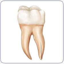 Image result for Tooth Fracture