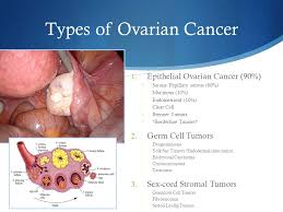 Family history of ovarian cancer is a risk factor; How To Know Symptoms Types And Causes Ovarian Cancer Women Must Read Black World 999