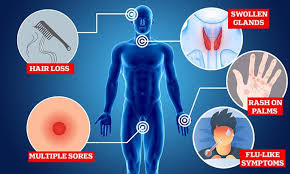 Image result for syphilis symptoms