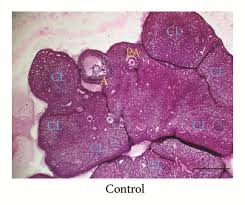 Image result for Phyllanthus muellerianus