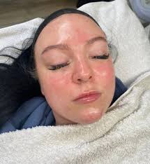 No-filter by Ebony Peters...