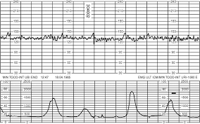 Uterine Contractions Obgyn Key