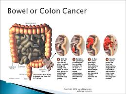 Indigestion and an uncomfortable or painful stomach sensation are the usual early sensations of gastric cancer. Pain In Left Side Here Are Major Causes Of Stomach Abdominal Pain In Left Side Video Dailymotion