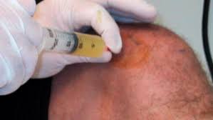 Image result for Septic Joint