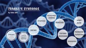 Fragile X Syndrome By Walaa
