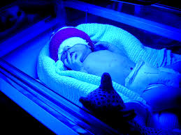 Image result for Kernicterus