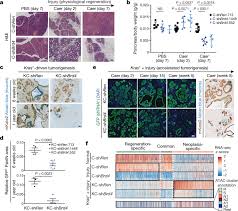 In (20) the presence of the egophoric marker signals the speaker's opinion. A Gene Environment Induced Epigenetic Program Initiates Tumorigenesis Nature