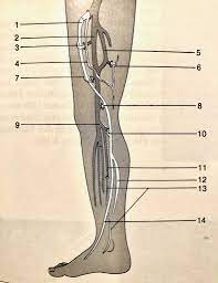 Saphenion Therapie Von Perforanzkrampfadern Mit Venenkleber