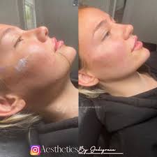 Aeatheticsbyjodigrace