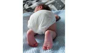 Zur beurteilung des ausmaßes der verletzung werden eine röntgenübersichtsaufnahme des beckens mit strahlengang von vorne, evtl. Mit Dem Popo Voran Geburtsbericht Einer Beckenendlage Hebammenblog De