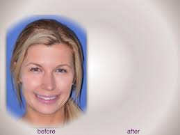 The Perfect Smile Studios