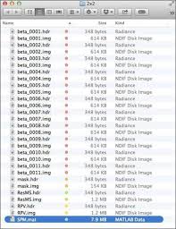 The first way is by passing a string to a shell. Single Subject First Level Fmri Data Analysis Bob Spunt Phd