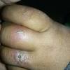 Neoformans after breathing in the microscopic fungus, although most people who are exposed to the fungus never get sick from it.c. Https Encrypted Tbn0 Gstatic Com Images Q Tbn And9gcrjw2kmm4gggu62ljxwxhg22mqvjr6q9kmaiy Muovbzzvx0pit Usqp Cau