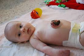 Watch this video to know how to gently care for your. Newborn Baby Umbilical Cord After It Falls Off Newborn Baby