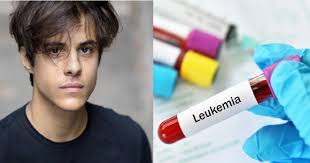 We did not find results for: Che Cos E La Leucemia Fulminante Che Ha Ucciso Michele Merlo Quali I Sintomi Quando Rivolgersi Al Medico Social Magazine