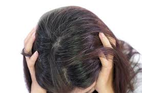 Gray before 30 is early. Premature Greying Yun Nam Hair Care