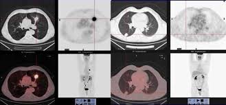 2018, în jurul orei 13.30, pe terenul de sport al colegiului național de arte regina maria din constanța a pătruns o fostă elevă, în vârstă de 25 de ani, care a intrat în dialog cu un grup de elevi de liceu. Multimodality Imaging Techniques Marti Bonmati 2010 Contrast Media Amp Molecular Imaging Wiley Online Library