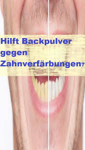 Hilft Backpulver Gegen Zahnverfarbungen Zahne Aufhellen Hausmittel Zahne Zahne Putzen
