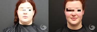 Revive Medical Spa: Expert Aesthetic & Wellness Treatments