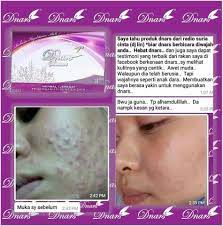Senarai ini dikemaskini setiap tahun. Khasiat Kunyit Didalam Golden Cream Dnars Skincare Hq Facebook