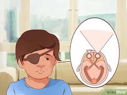 Lazy eye treatment for all ages, including older children and adults early detection and treatment is ideal, yet the most commonly known treatments for lazy eye in children are elective eye muscle surgery and/or eye patching. How To Get Rid Of A Lazy Eye With Pictures Wikihow