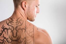 Tattoo removal services for this ink is broken into tiny fragments that the body's immune system breaks down and removes from the. How Much Does Tattoo Removal Cost 2021 Price Guide
