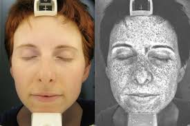 Image result for Sun Exposure