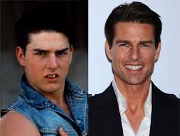 Download now kartun paling jorok banget 123vid. Foto Super Jorok Gigi Artis Artis Ini Tak Seindah Bayanganmu Kapanlagi Com