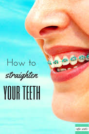 Do you know how long braces take to straighten teeth? 4 Proven Ways To Straighten Crooked Or Misaligned Teeth