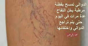 علاج دوالي القدمين health and beauty tips health healthy eating diets