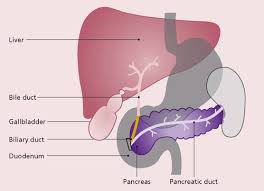 What's more, pancreatic cancer is tough to spot early, and many of the symptoms can be caused by other conditions. Early Diagnosis Of Pancreatic Cancer In A Nurse Led One Stop Jaundice Service Gastrointestinal Nursing