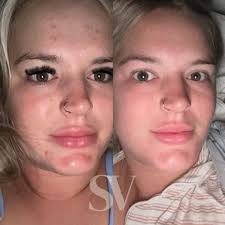 SkinView Esthetics (@skinview.esthetics) · Longview, TX