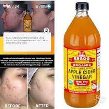 Check spelling or type a new query. Bragg Cuka Apel Toner Siap Pakai Ratio 1 2 Share In Bottle Shopee Indonesia