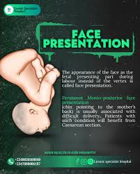 Image result for Face Presentation