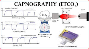 Image result for Colorimetric Capnometry