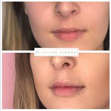 Dr. Louise Pierre Aesthetics
