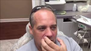 Amazing Implant Procedure by Smileology