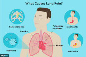The lungs are located in the chest, behind the rib cage on either side of the heart. Lung Pain Causes Treatment And When To See A Doctor