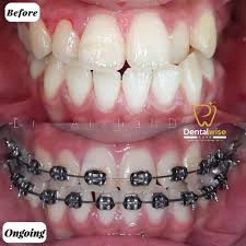 Klinik pergigian hazlina 3 years ago. Klinik Gigi Pasir Gudang Kota Masai Dentalwise Care
