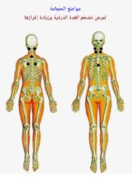 الحجامة Posts Facebook