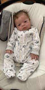 Williams Syndrome November 2018 Babies Forums What To Expect