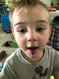 Picture #1: theo acting like a punk rocker, tore a hook off his toy car and  used it as a lip ring. All