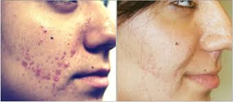 Rachel — VILLANI MEDICAL