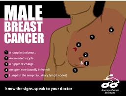 Signs and symptoms of breast cancer in men. Bwgovernment Male Breast Cancer A Lump In The Breast Facebook